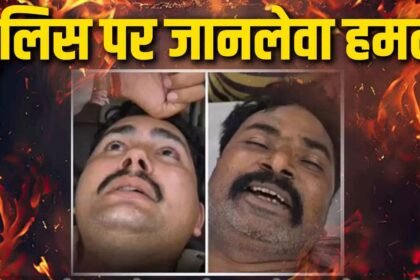 Attack On MP Police
