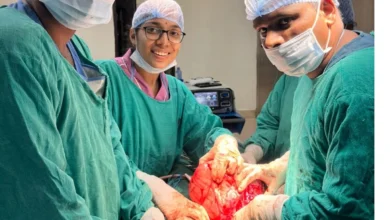 Raigarh Medical College Tumor Surgery : महिला के पेट से निकला 8 किलो का विशाल ट्यूमर, रायगढ़ मेडिकल कालेज के डाक्टरों ने हाई रिस्क आपरेशन में बचाई जान