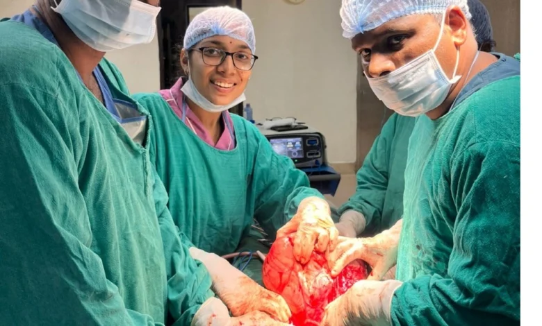 Raigarh Medical College Tumor Surgery : महिला के पेट से निकला 8 किलो का विशाल ट्यूमर, रायगढ़ मेडिकल कालेज के डाक्टरों ने हाई रिस्क आपरेशन में बचाई जान