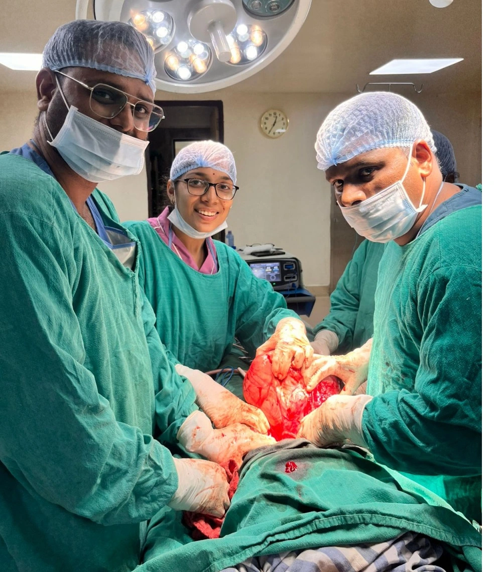 Raigarh Medical College Tumor Surgery  :  महिला के पेट से निकला 8 किलो का विशाल ट्यूमर, रायगढ़ मेडिकल कालेज के डाक्टरों ने हाई रिस्क आपरेशन में बचाई जान